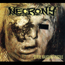Necrony "Severe Malignant Pustule" Digipak CD