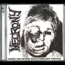 Necrony "Under the Severe Mucu-Purulent Pustule" Double CD